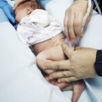 Ecografia de șold - când trebuie făcut screening pentru displazia de șold